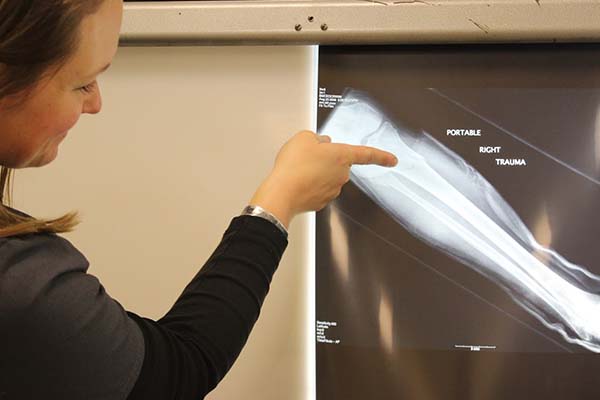 MCLA radiology instructor pointing at medical imaging